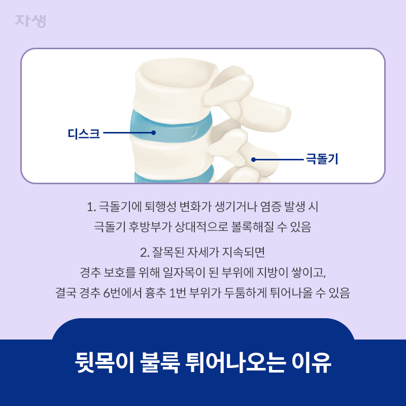 참고 이미지 : 뒷목이 불룩 튀어나오는 이유 | 자생한방병원·자생의료재단