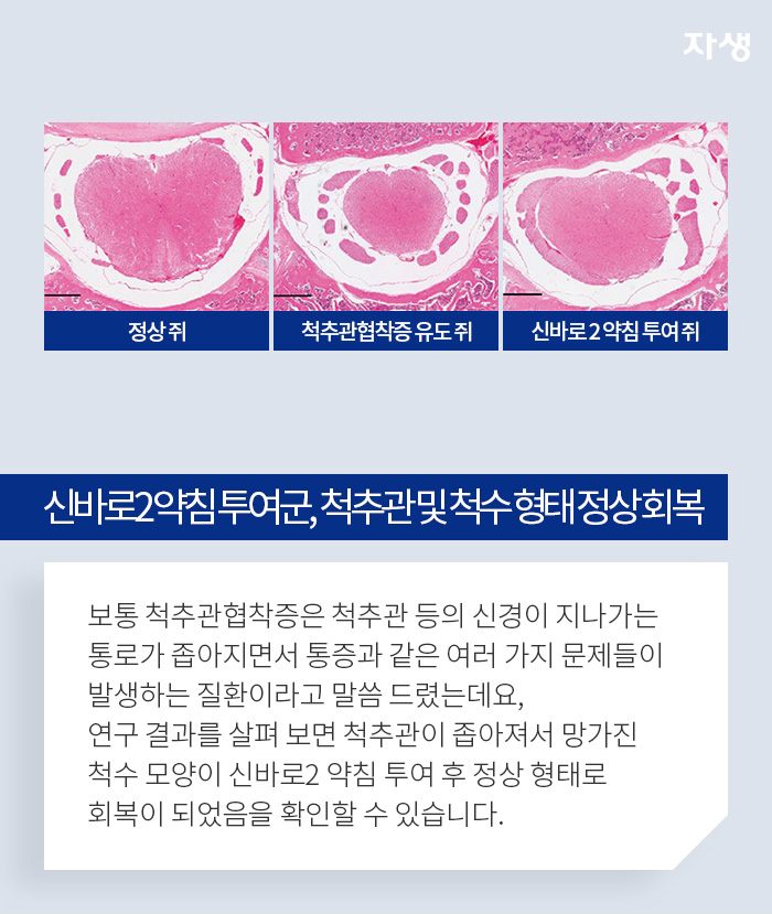 신바로2약침투여군, 척추관 및 척수 형태 정상회복 - 보통 척추관협착증은 척추관 등의 신경이 지나가는 통로가 좁아지면서 통증과 같은 여러 가지 문제들이 발생하는 질환이라고 말씀드렸는데요. 연구 결과를 살펴보면 척추관이 좁아져서 망가진 척수 모양이 신바로2 약침 투여 후 정상 형태로 회복이 되었음을 확인할 수 있습니다.