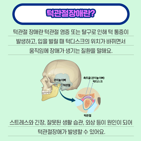 타이틀 이미지 : 턱관절장애란?? 턱관절 장애란 턱관절 염증 또는 탈구로 인해 턱 통증이 발생하고, 입을 벌릴 때 턱디스크의 위치가 바뀌면서 움직임에 장애가 생기는 질활을 말해요. 스트레스와 긴장, 잘못된 생활습관, 외상 등이 원이이 되어 턱관절장애가 발생할 수 있어요.| 자생한방병원·자생의료재단