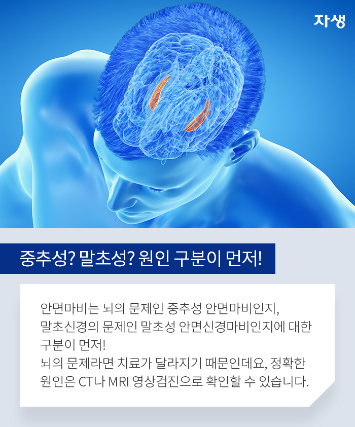 중추성? 말초성? 원인 구분이 먼저! 안면마비는 뇌의 문제인 중추성 안면마비인지, 말초신경의 문제인 말초성 안면신경마비인지대한 구분이 먼저! 뇌의 문제라면 치료가 달라지기 때문인데요, 정확한 원인은 CT나 MRI 영상검진으로 확인할 수 있습니다.