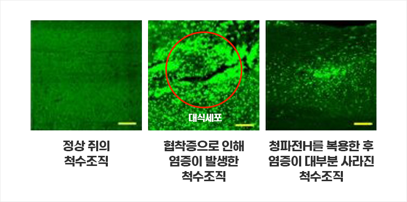 정상 쥐의 척수조직와 척추관협착증 유발 쥐의 척수조직와 청파전H를 복용한 쥐의 척수조직 비교 | 자생한방병원·자생의료재단