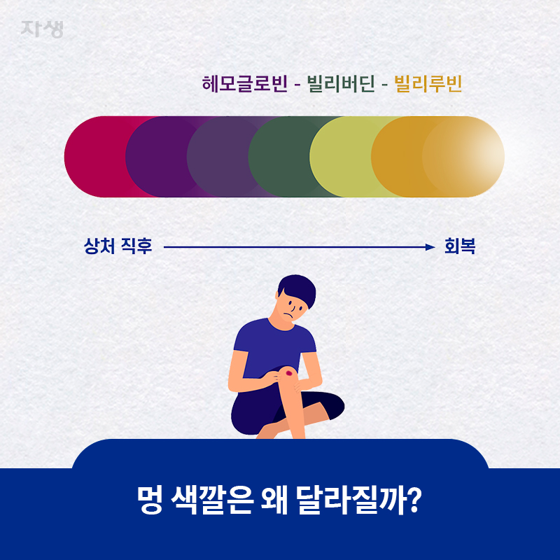 참고 이미지 : 멍 색깔은 왜 달라질까? | 자생한방병원·자생의료재단