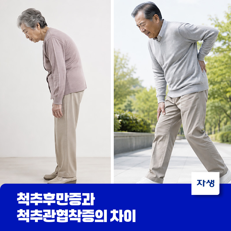 척추후만증과 척추관협착증의 자세 비교