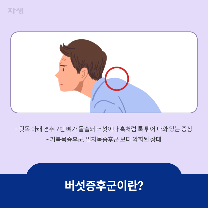 참고 이미지 : 버섯증후군이란? | 자생한방병원·자생의료재단