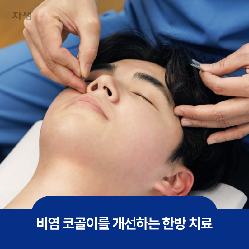 비염 코골이를 개선하는 한방 치료 중 하나인 침 치료 모습