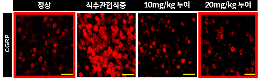동물실험에서도 후근신경절(DRG) 조직에서 자하거 약침 투여량에 따라 통증 관련 단백질(CGRP)이 농도의존적으로 회복됐다 | 자생한방병원・자생의료재단