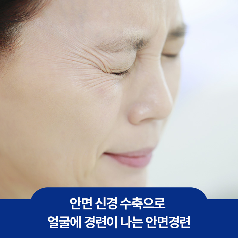 안면신경 수축으로 얼굴에 경련이 나타나는 상황을 설명하는 이미지