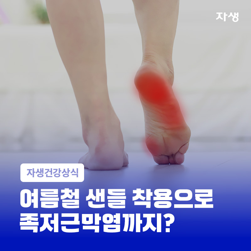 여름철 샌들 착용으로 발바닥 전체에 압력이 가해져 발바닥이 붉게 표시된 이미지