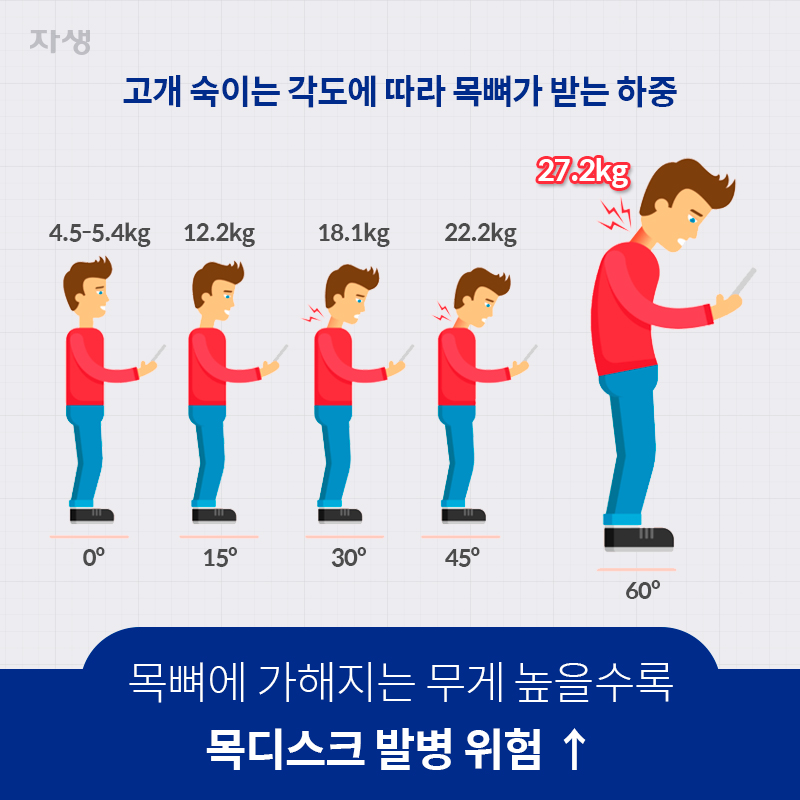 목뼈에 가해지는 무게 높을수록 목디스크 발병 위험 ↑ | 자생한방병원·자생의료재단