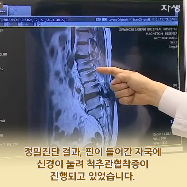 자생의료재단 자생한방병원 별다방! 별걸 다 해주는 고향닥터 - 뭣이 중헌디! ‘내 허리가 중허지’전라도 곡성의 전동차 타는 어머니 이야기13