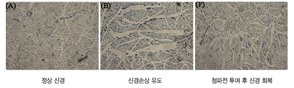 맨 왼쪽부터 정상 신경 사진, 신경손상 유도 사진, 청파전 투여 후 신경 회복 사진.